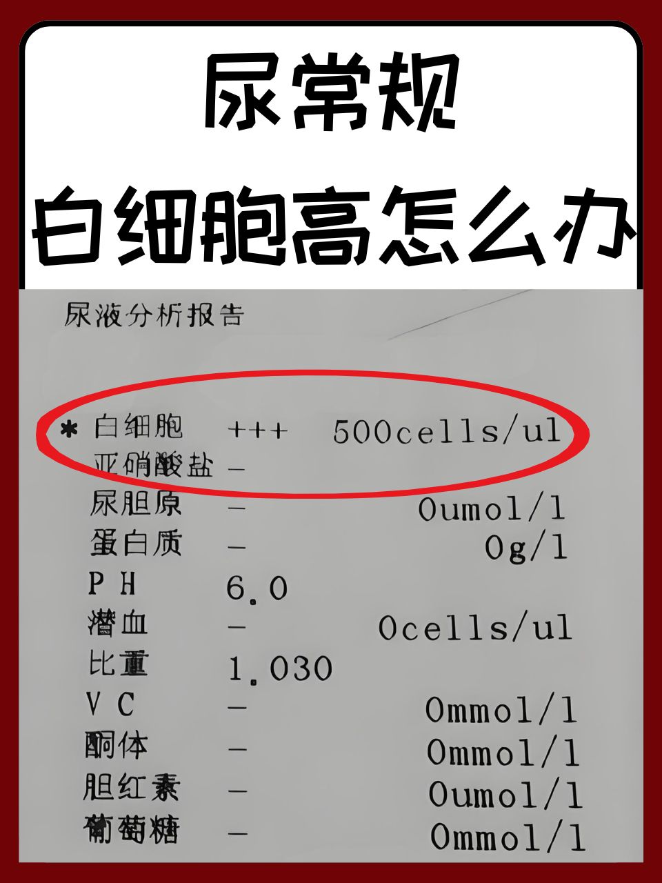 白细胞多少为正常