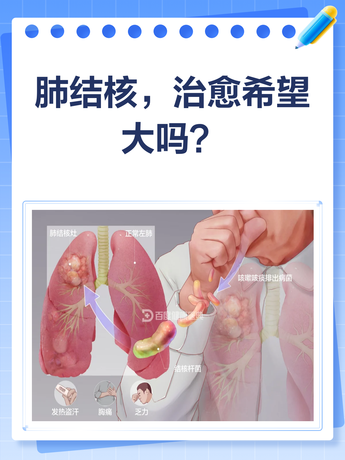 肺结核可以彻底治愈吗.
