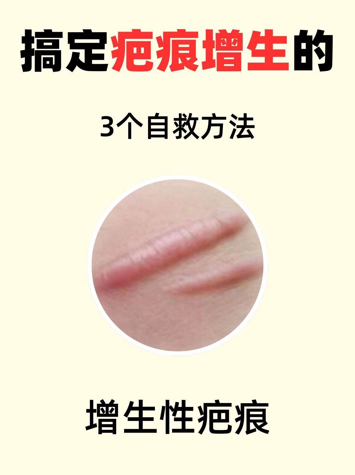 小叶增生怎么治疗