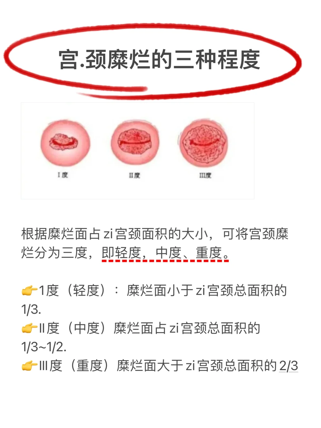 宫颈糜烂是怎么得的?