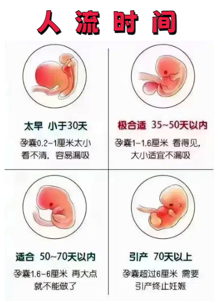 人流一般要多长时间