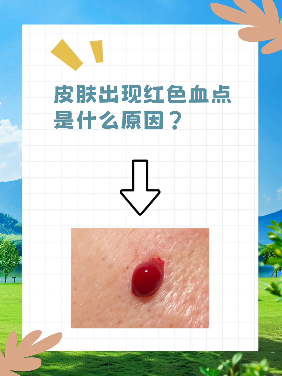 身上好多小血点是什么
