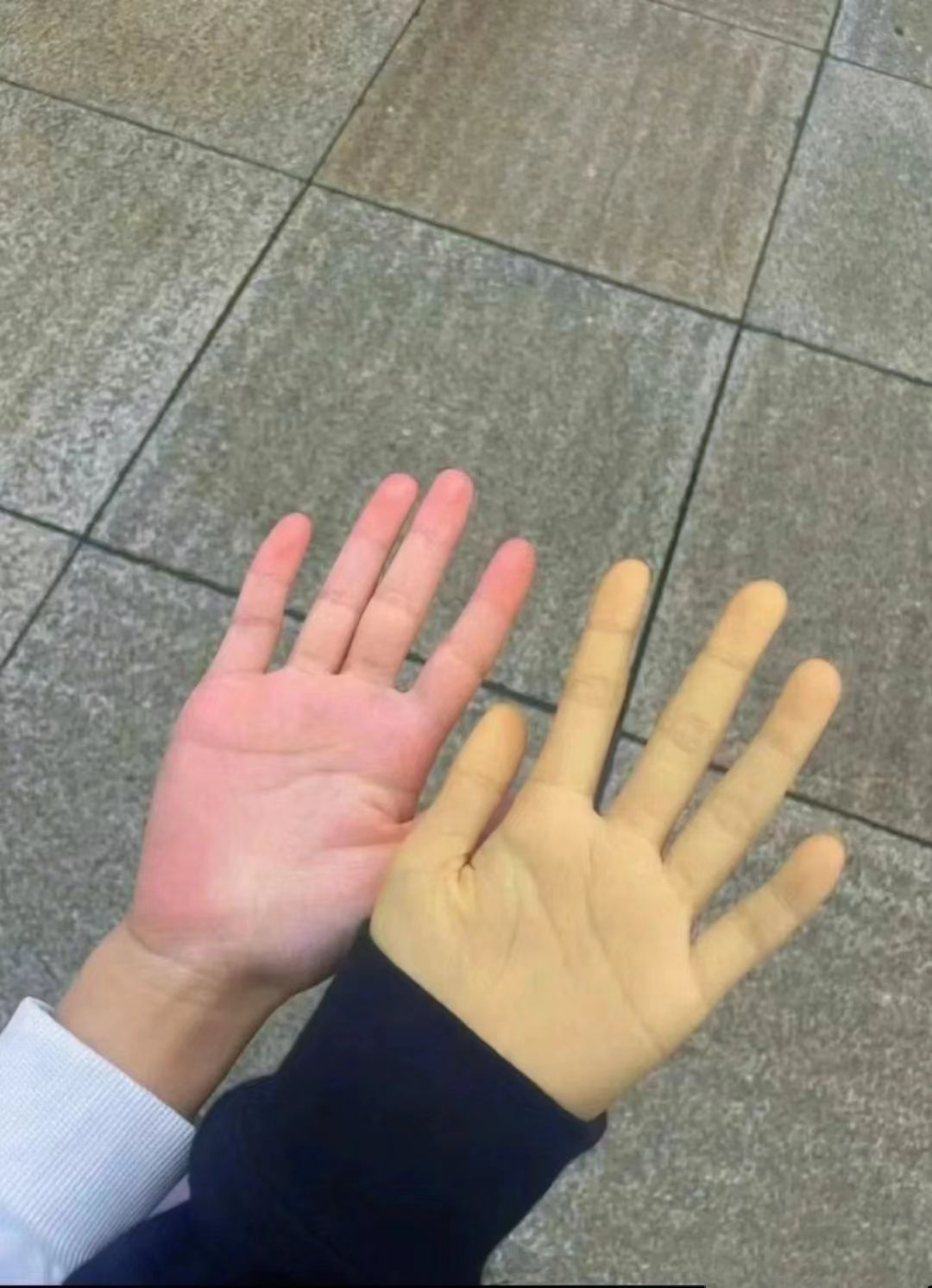 手掌泛黄是什么原因