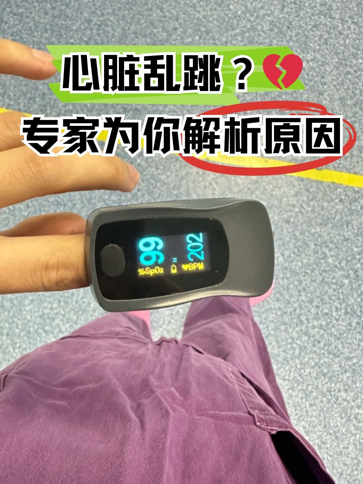 心脏跳动不规律