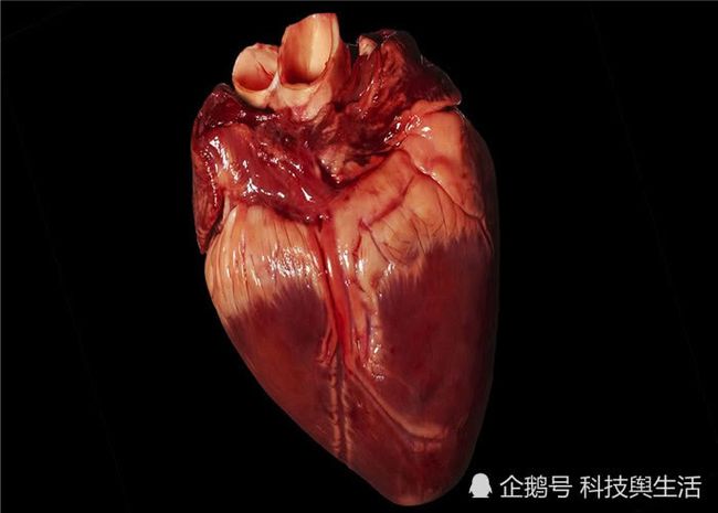 心脏移植后能活多久