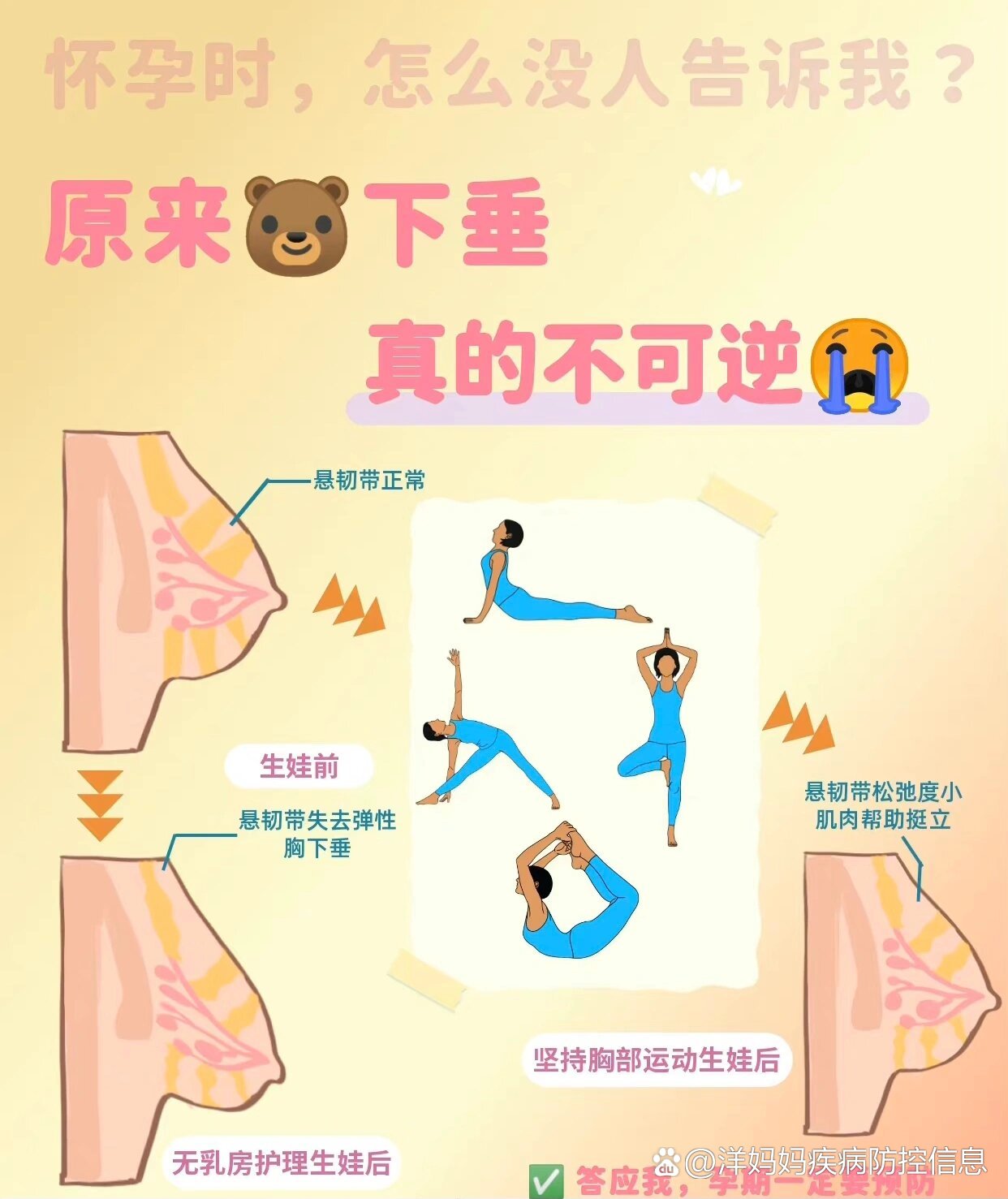 乳房下垂应该怎么办