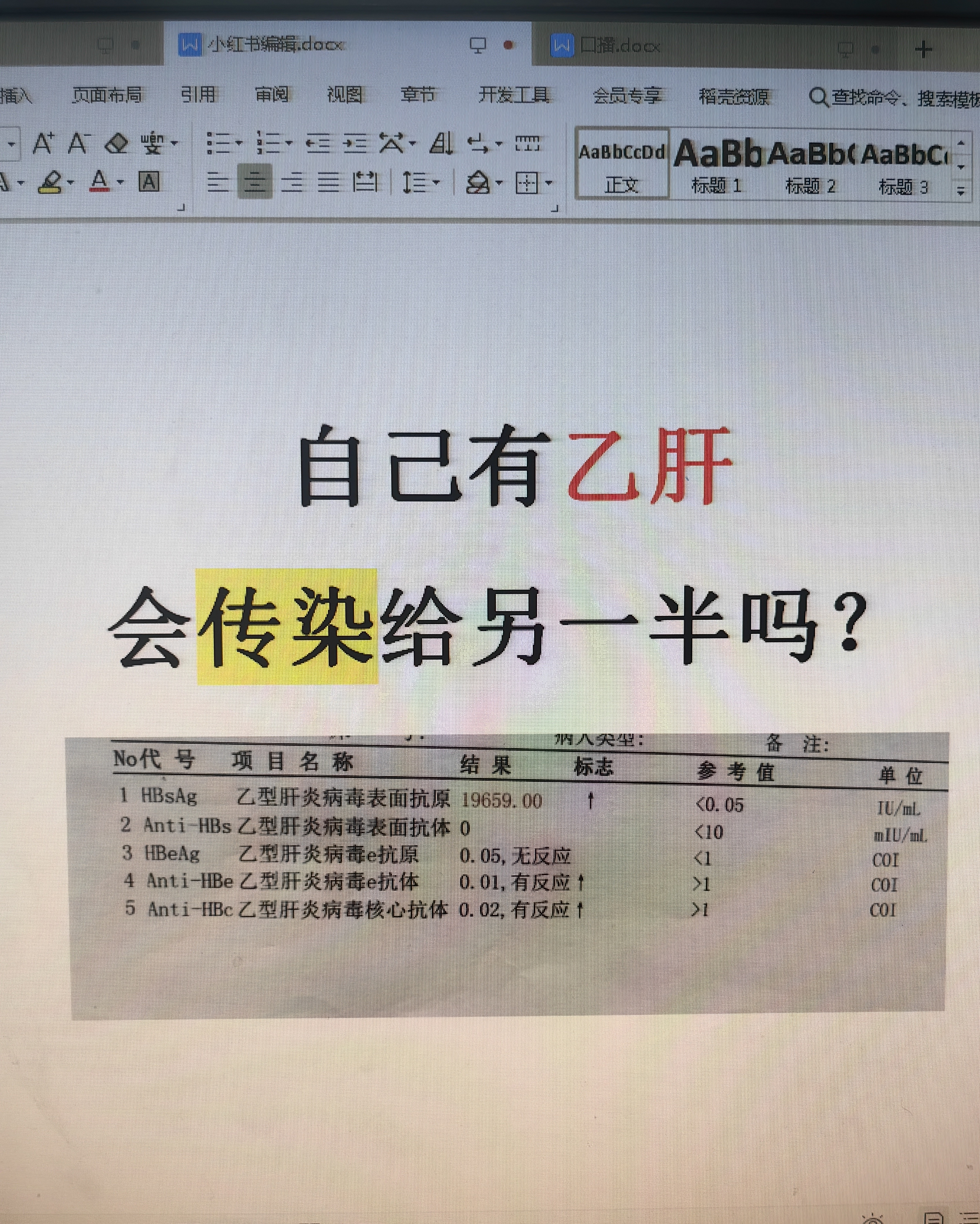 乙肝病毒携带者,严重吗?