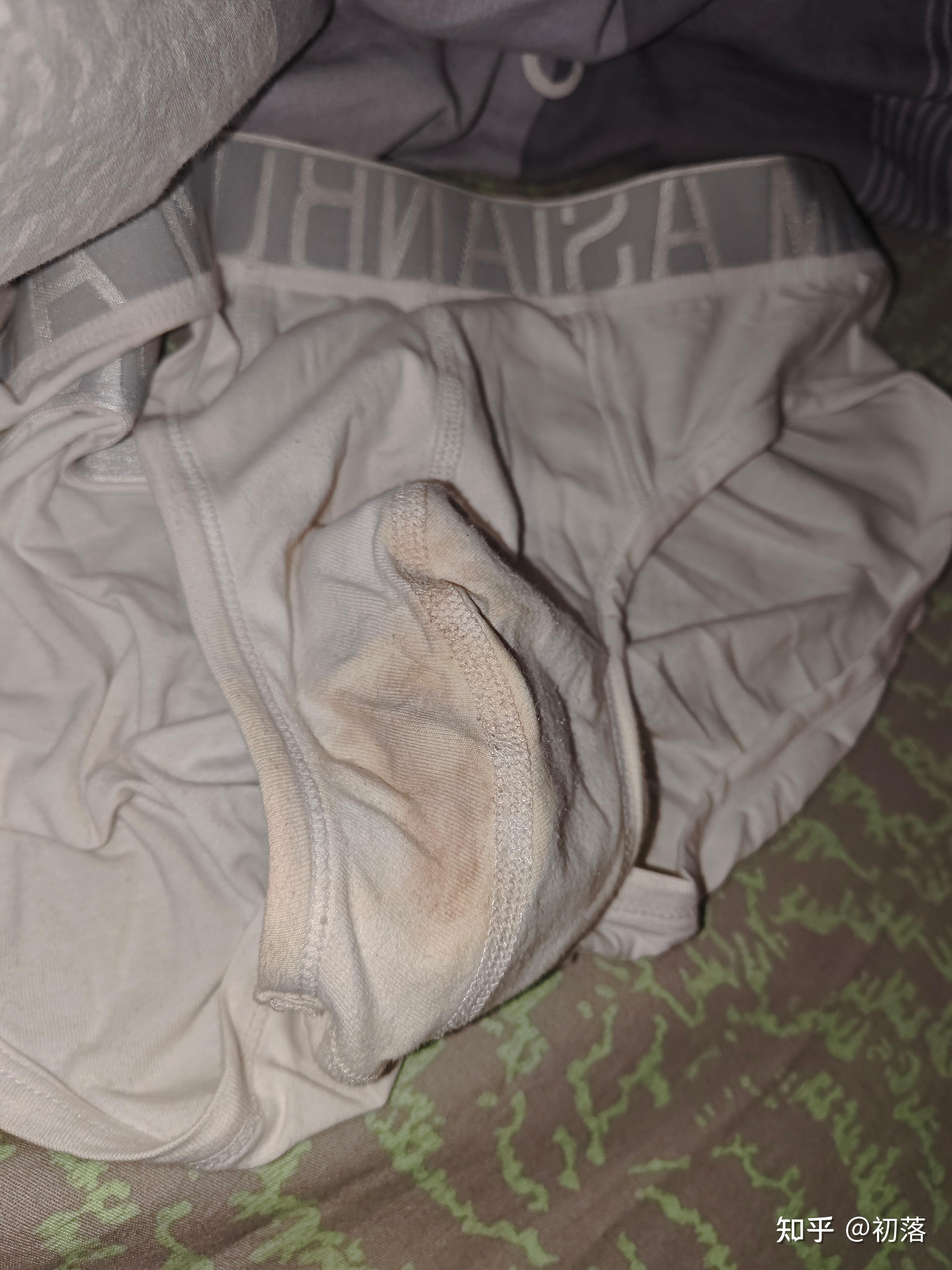 经常遗精是什么问题？