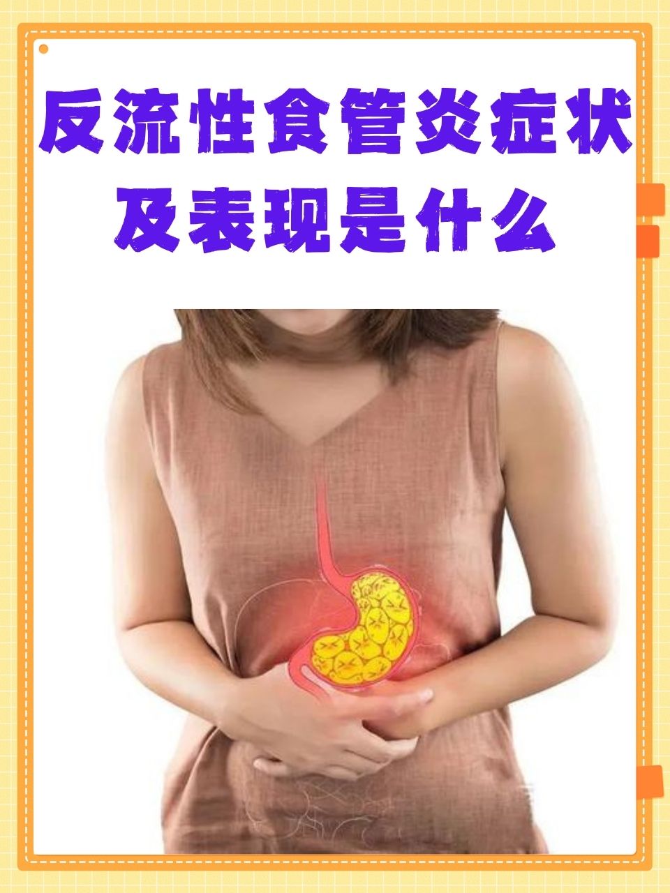 食管炎的症状能自愈吗