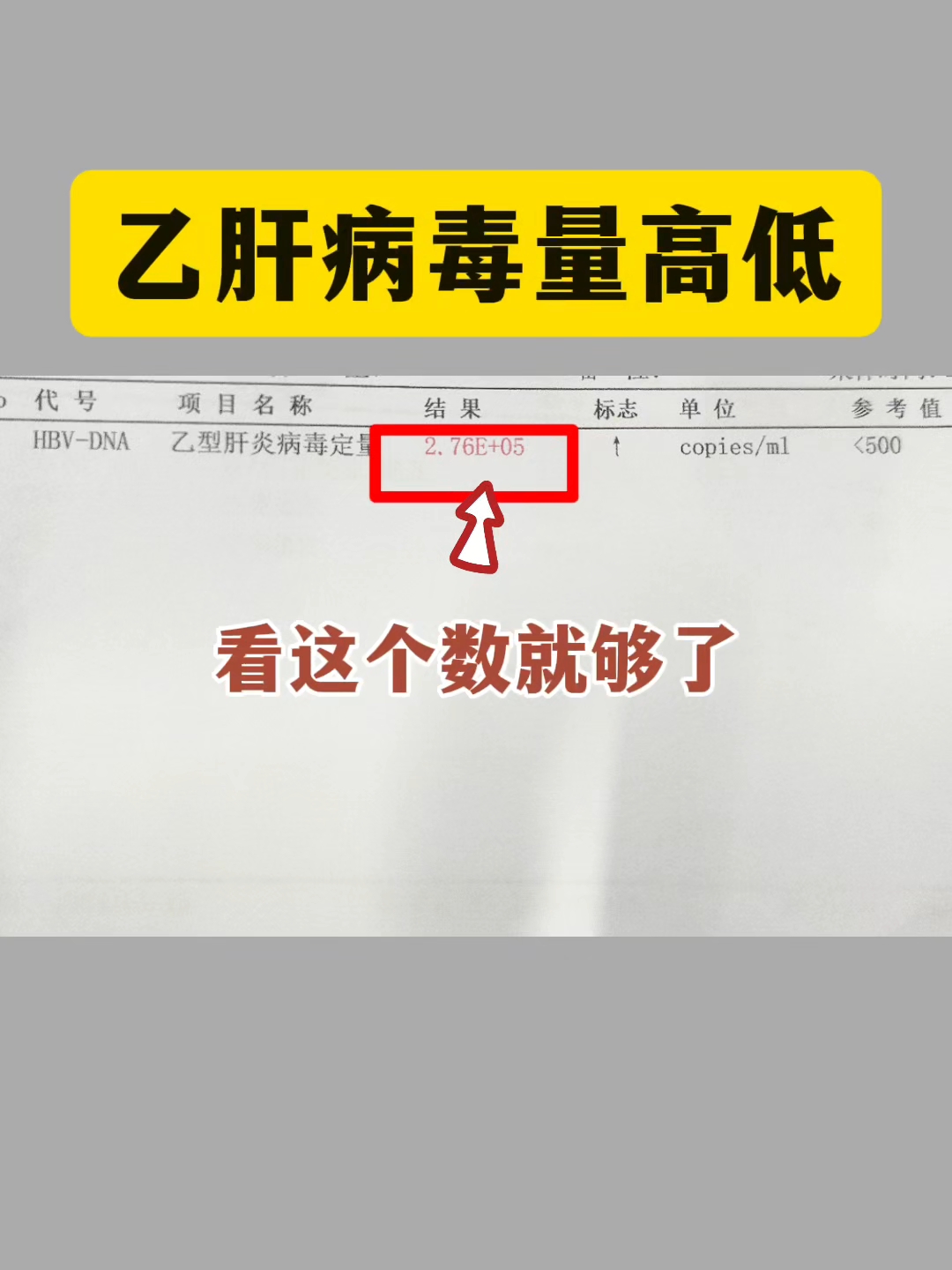 乙肝阴性是什么意思