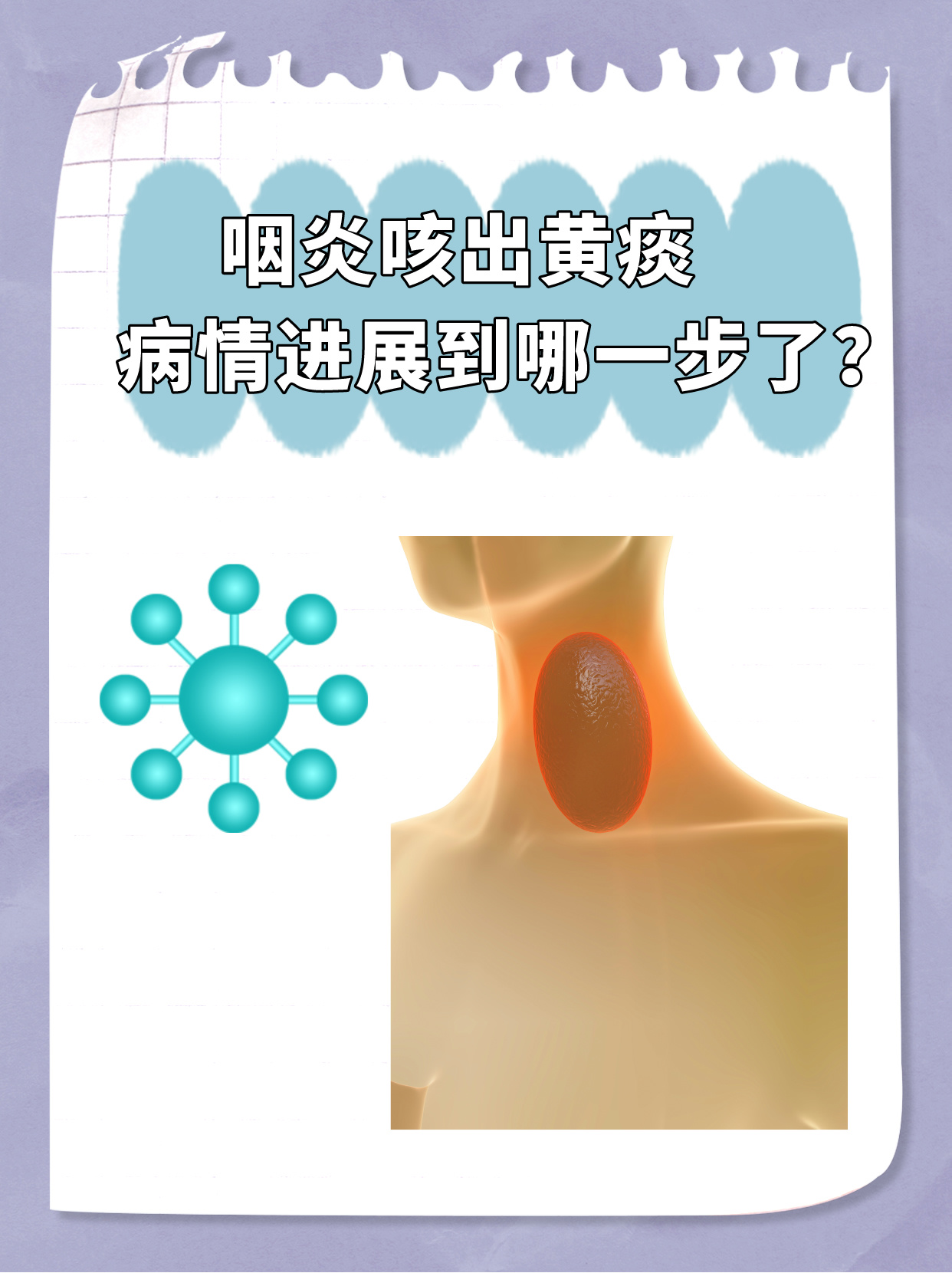 喉咙有痰,咳不出