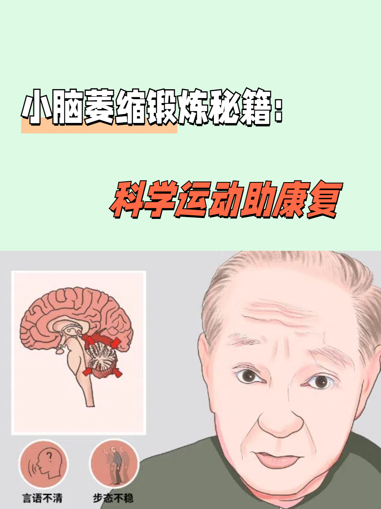 老年性脑改变是什么意思,