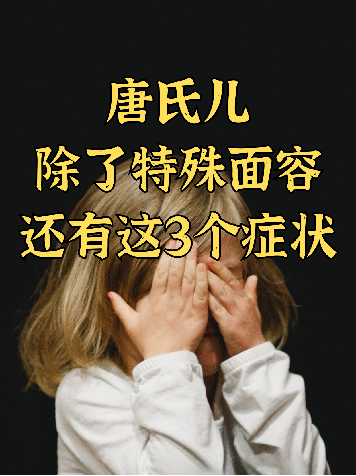 唐氏综合证是什么