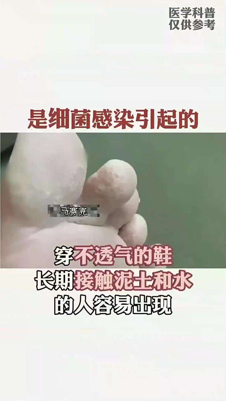 脚底下有好多小孔,像蜂窝一样