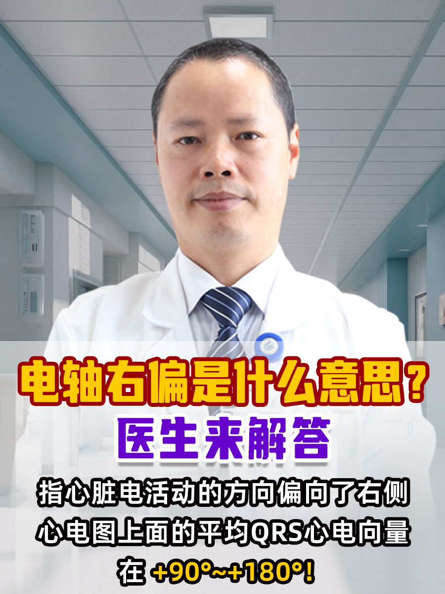 窦性心律心电轴右偏什么意思