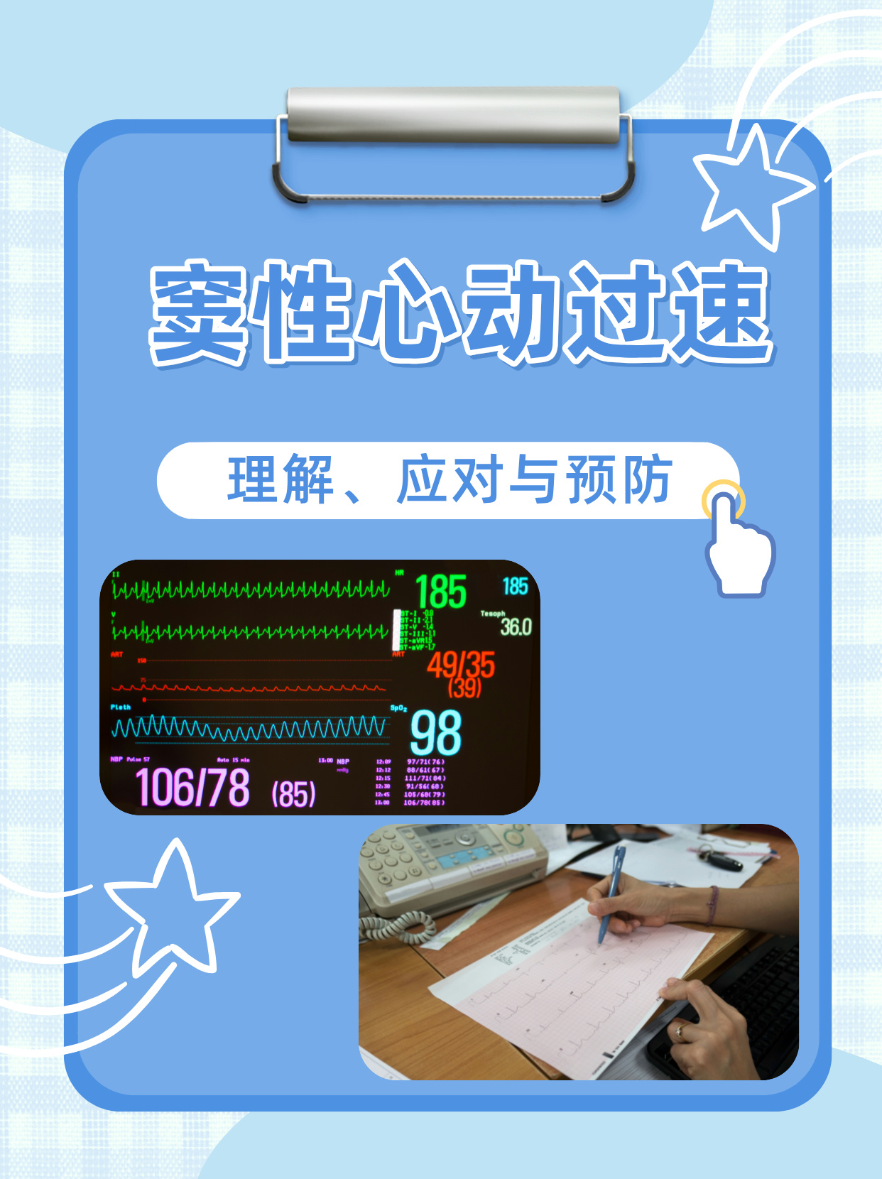 窦性心动过速需要如何治疗