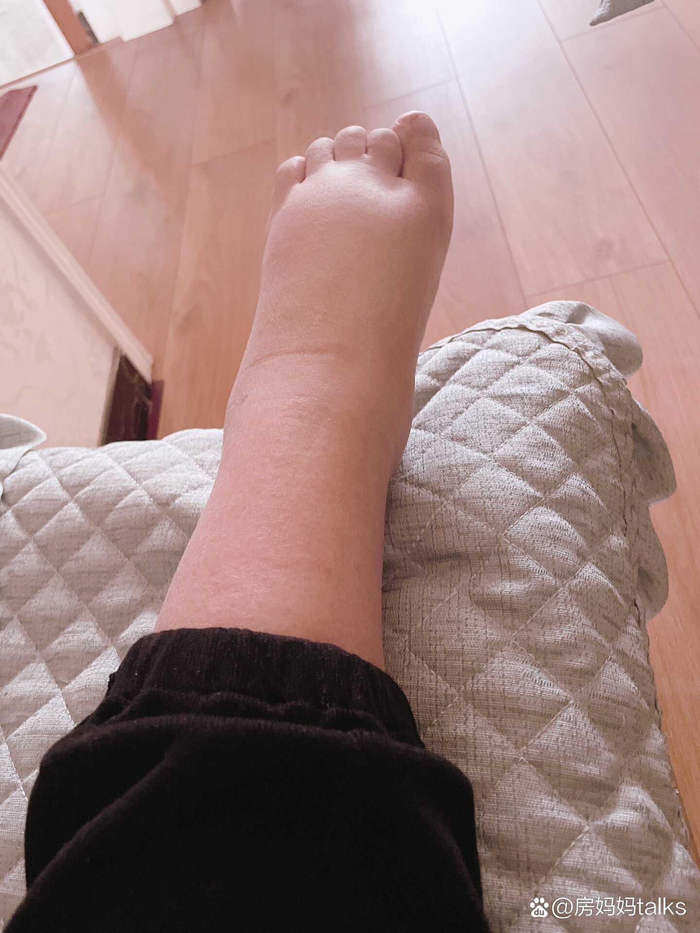 孕妇脚肿怎么回事