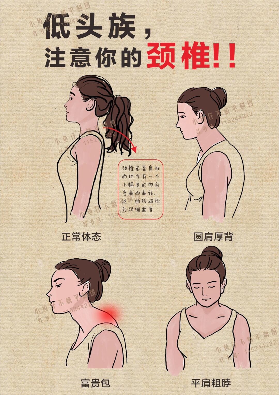 颈椎病引起的头晕怎么办