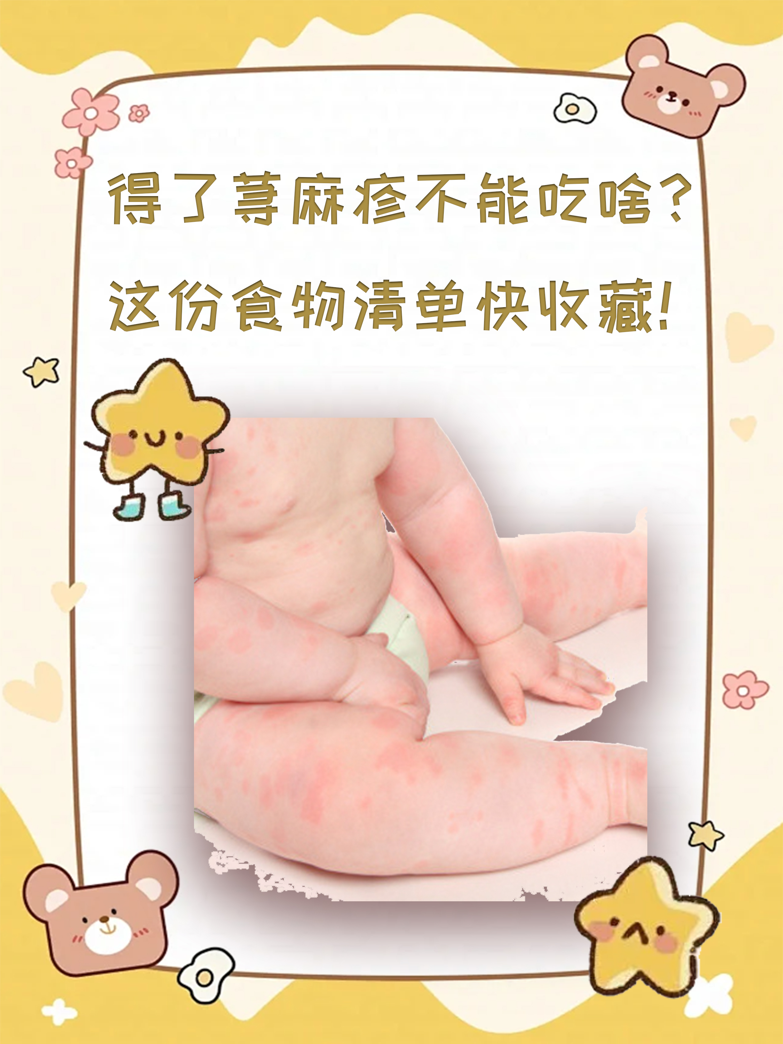 得了荨麻疹不能吃什么