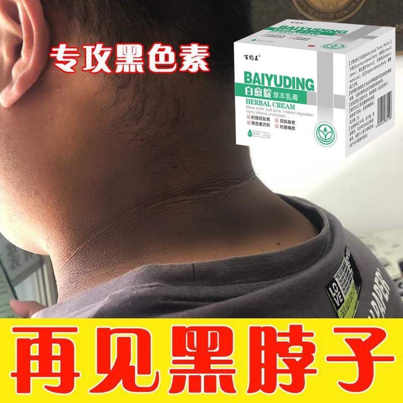 色素沉着用什么药膏,谢谢