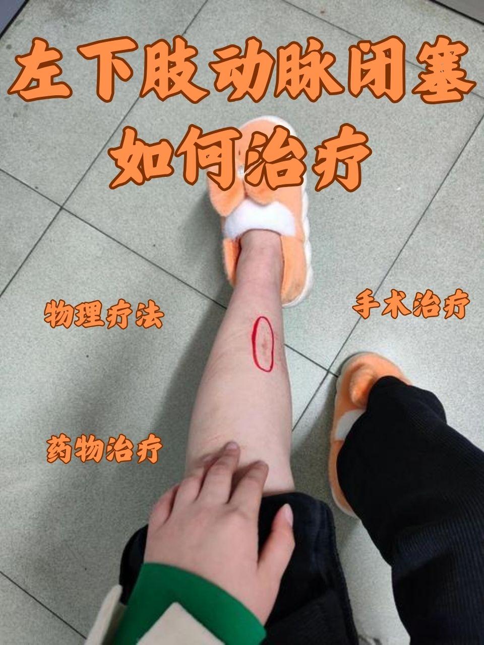 腿部血栓能治好吗