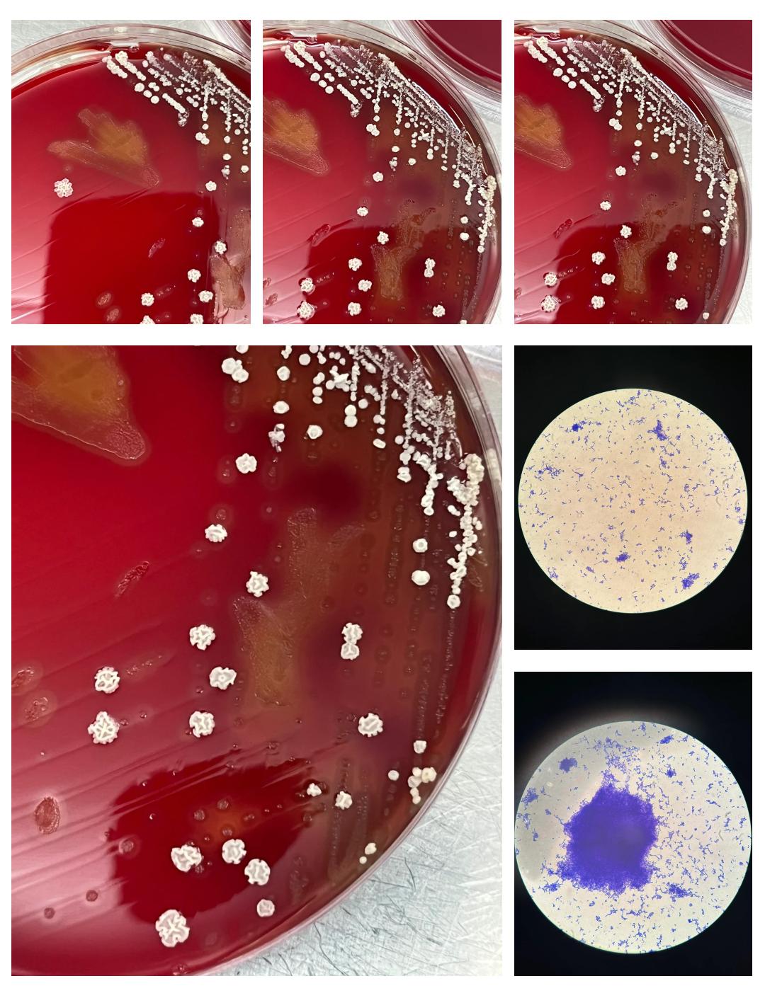 什么原因引起的链球菌感染