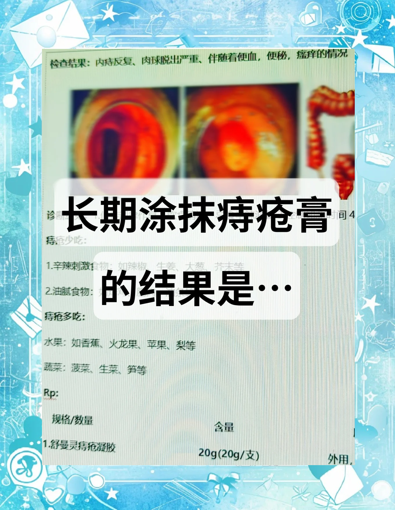 痔疮割了还会复发吗