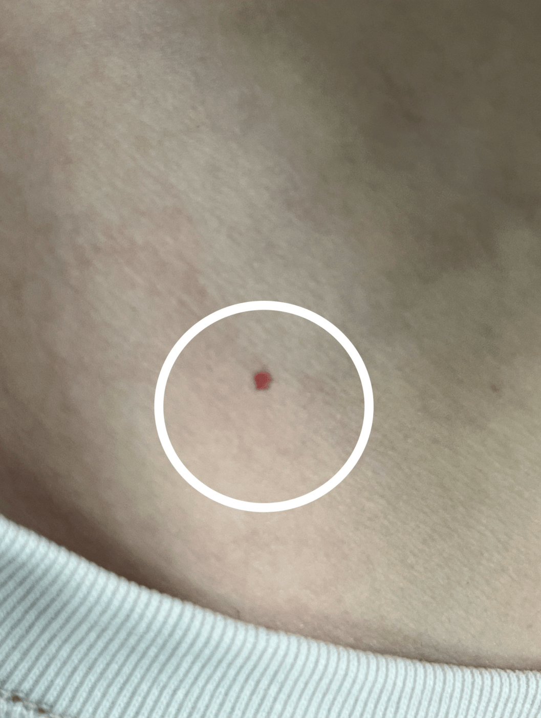 身上小红点,不痛不痒