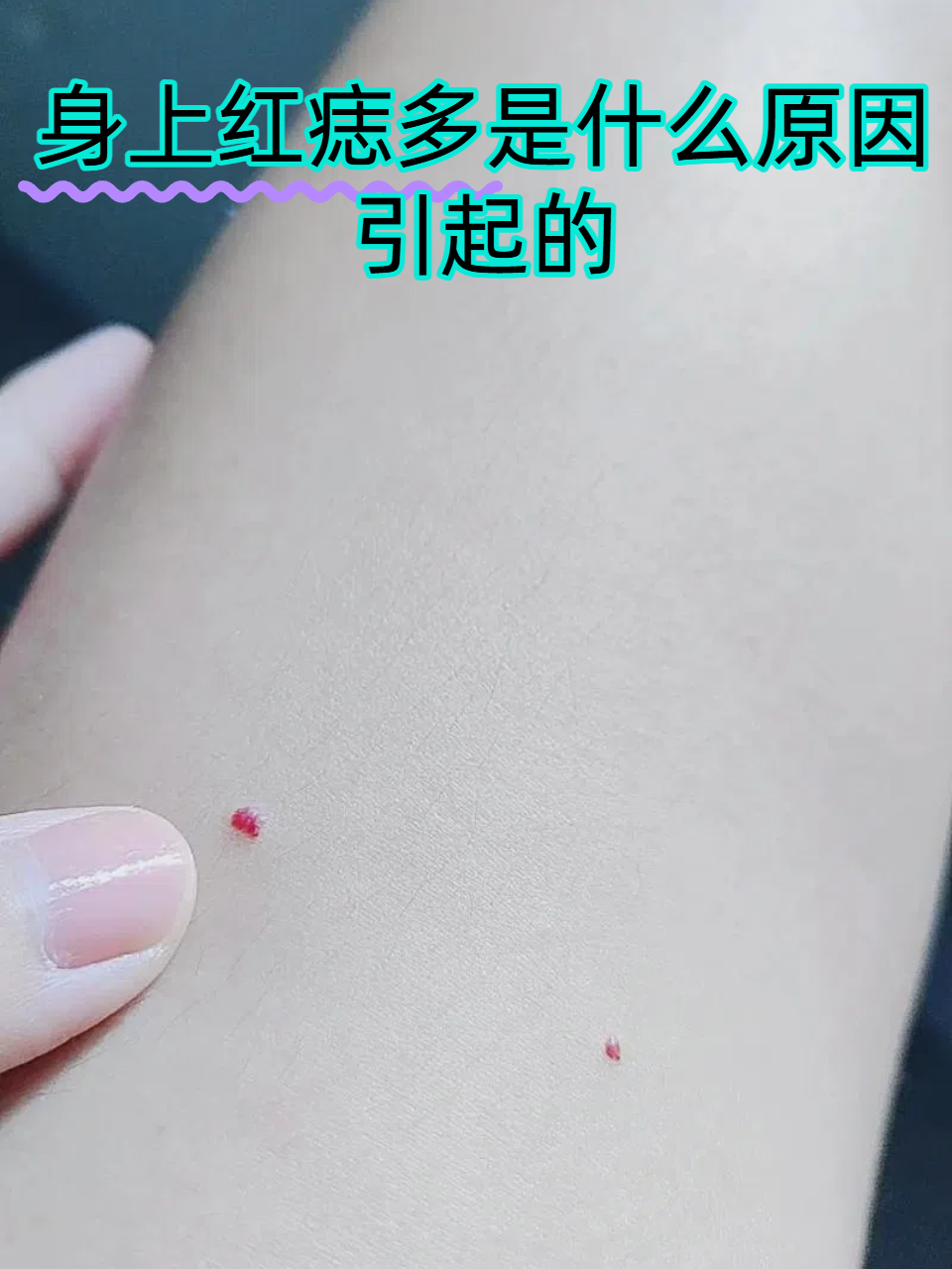 身上小红点,不痛不痒