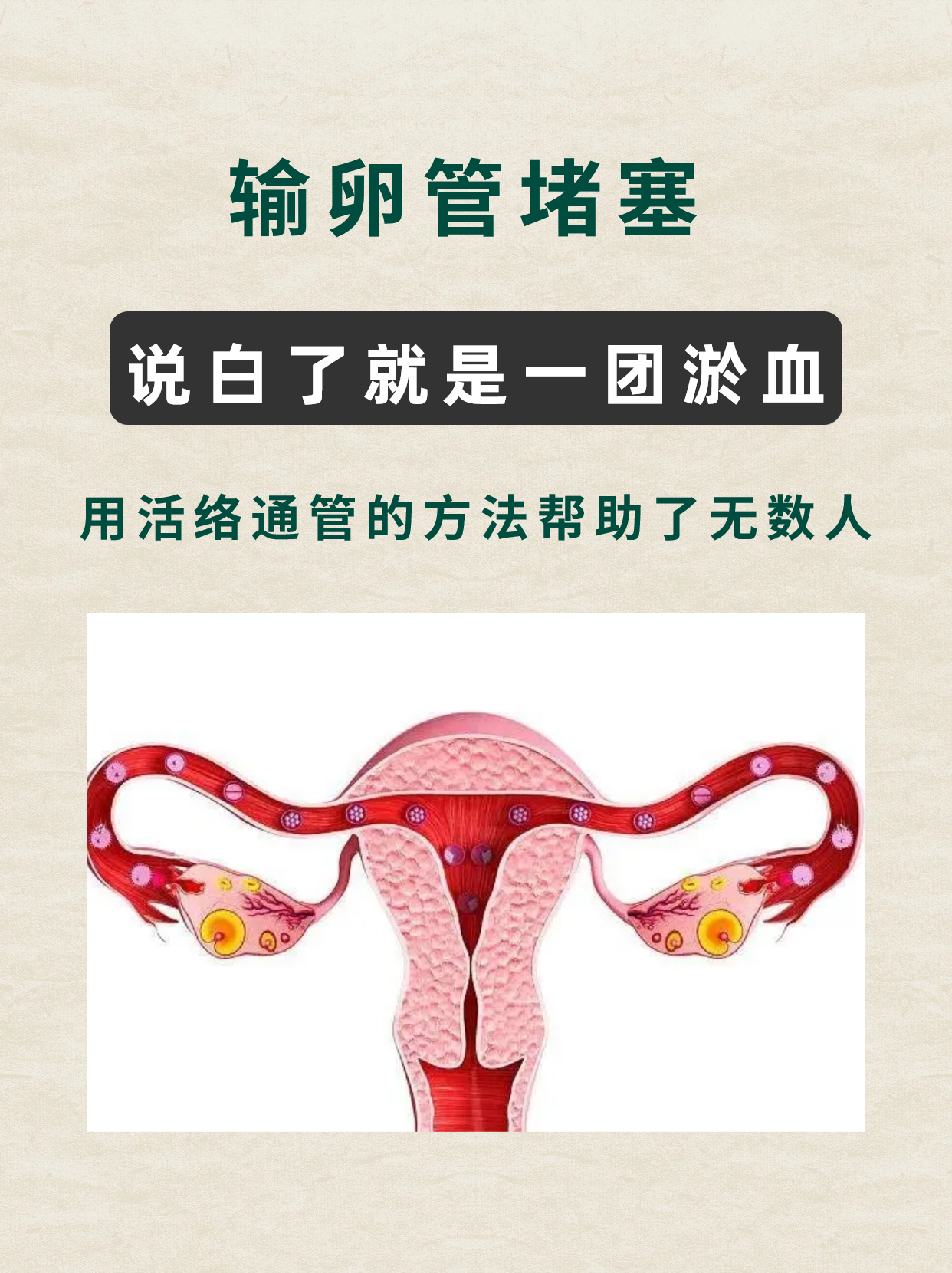 输卵管堵塞怎么疏通