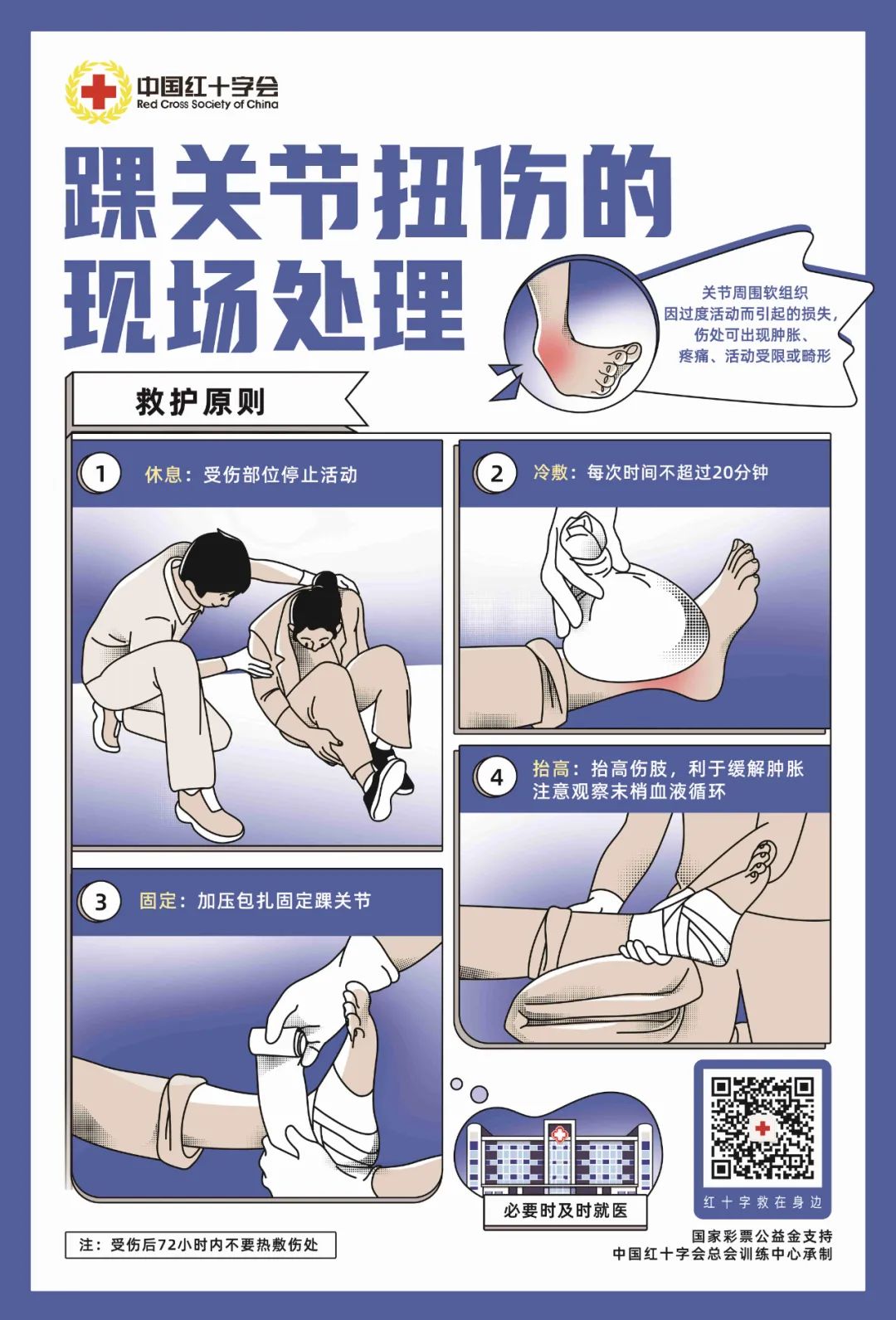 脚踝扭伤浮肿怎么办