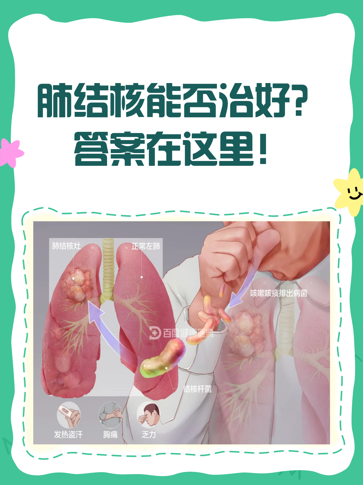 肺结核的传播途径有哪些