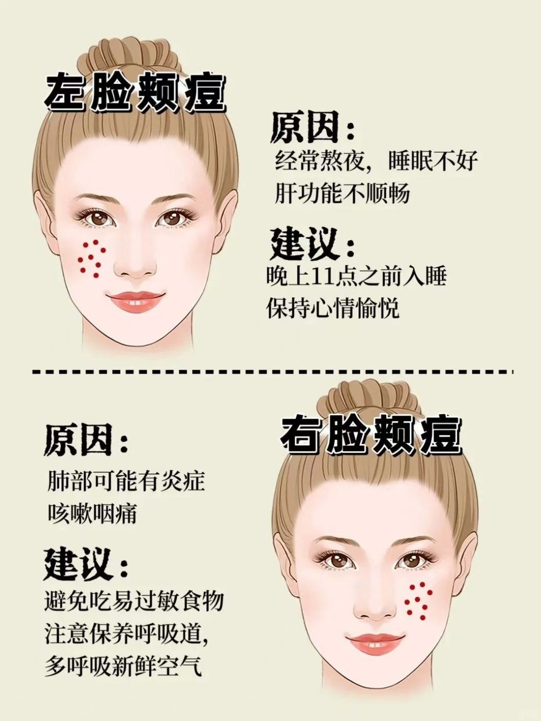 嘴巴周围长痘痘是什么原因