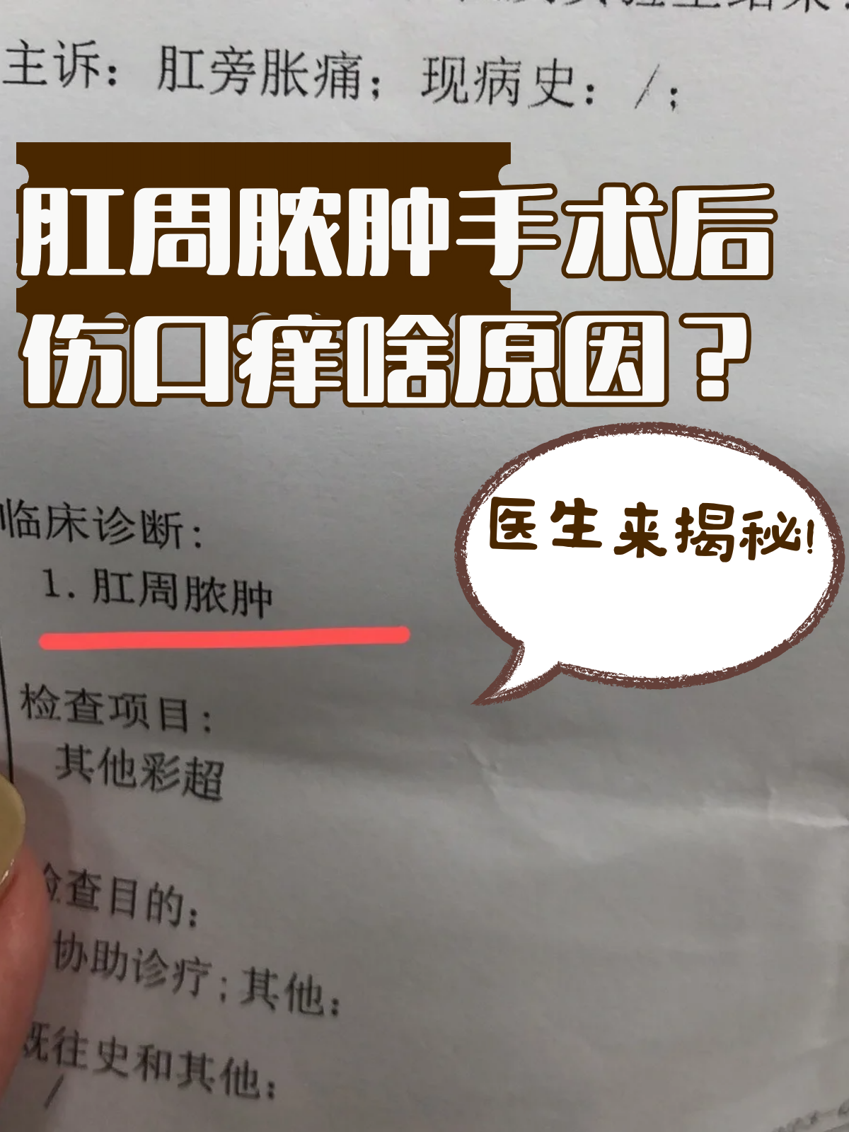 伤口发痒怎么回事