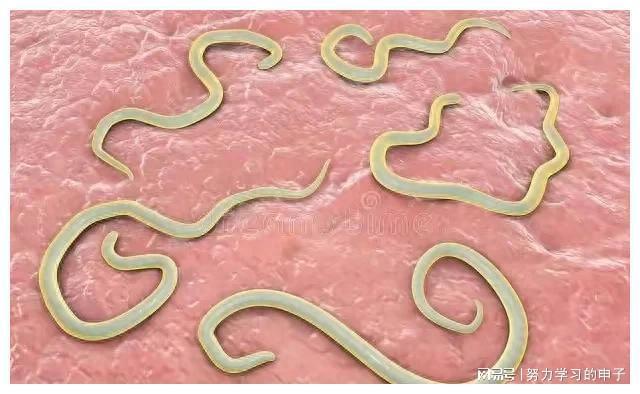 怎么判断肚子里有没有虫子?