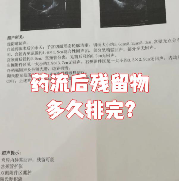 药流后多久能出门?