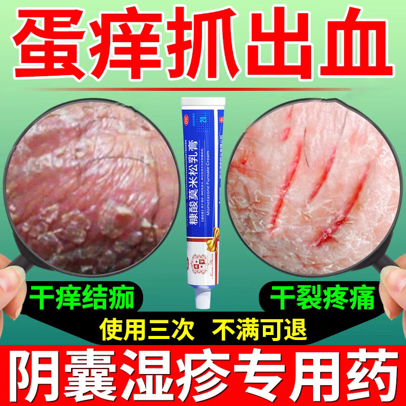 阴囊潮湿该吃什么药来治疗?