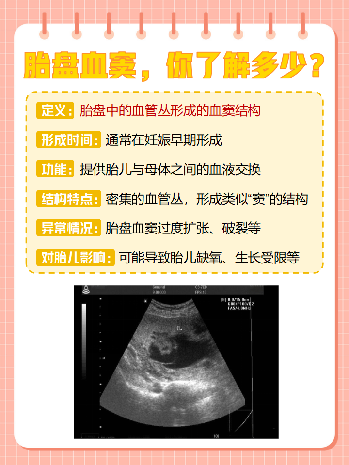 前置胎盘长上去的几率