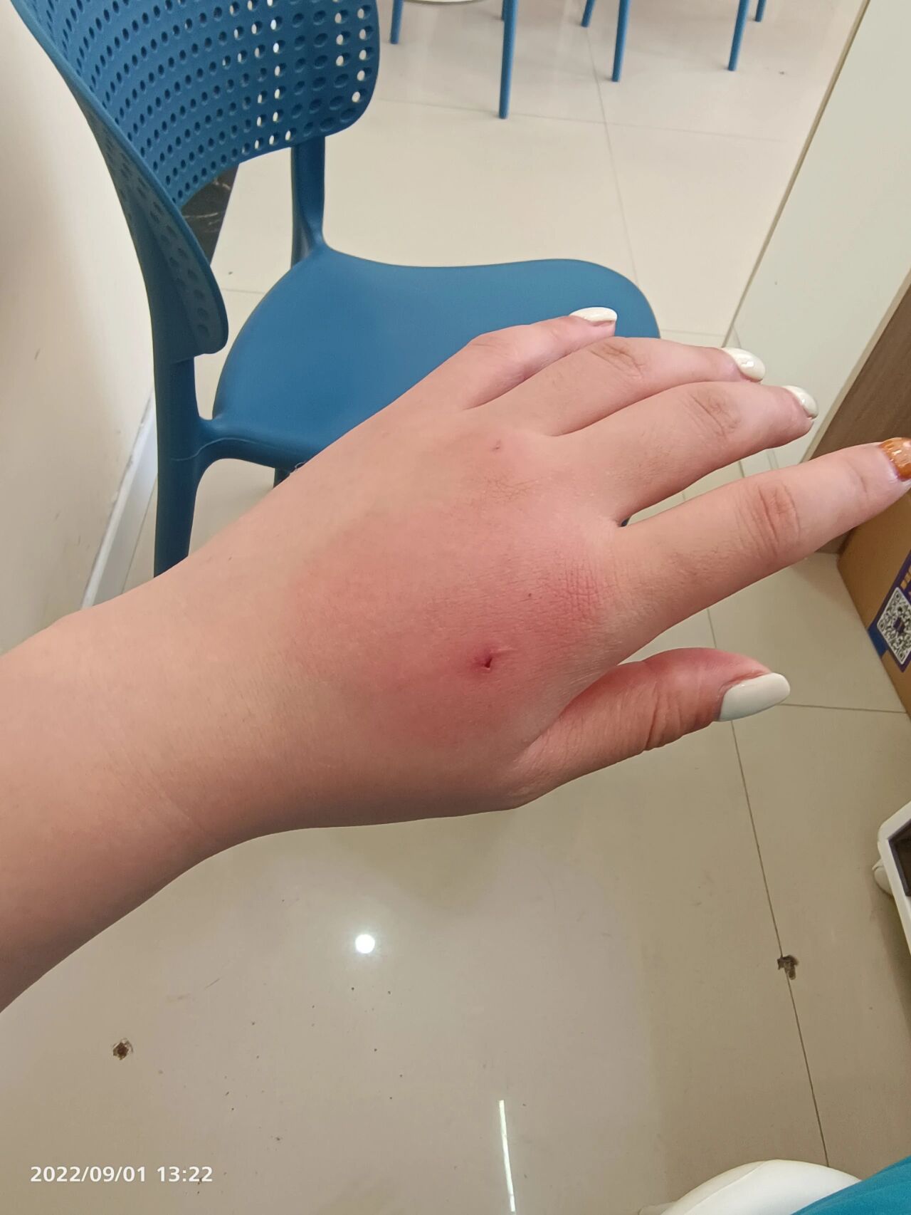 被小猫咬了一个小眼儿