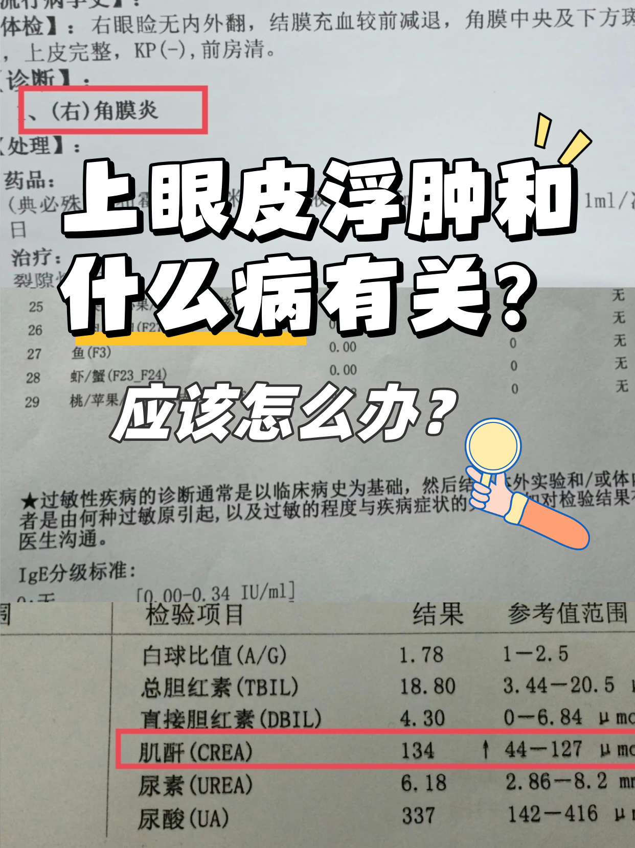 上眼皮肿是怎么回事