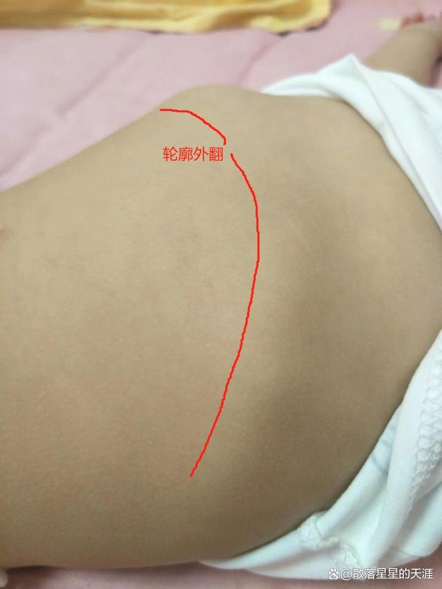 请问我是鸡胸吗?今天发了个照片,