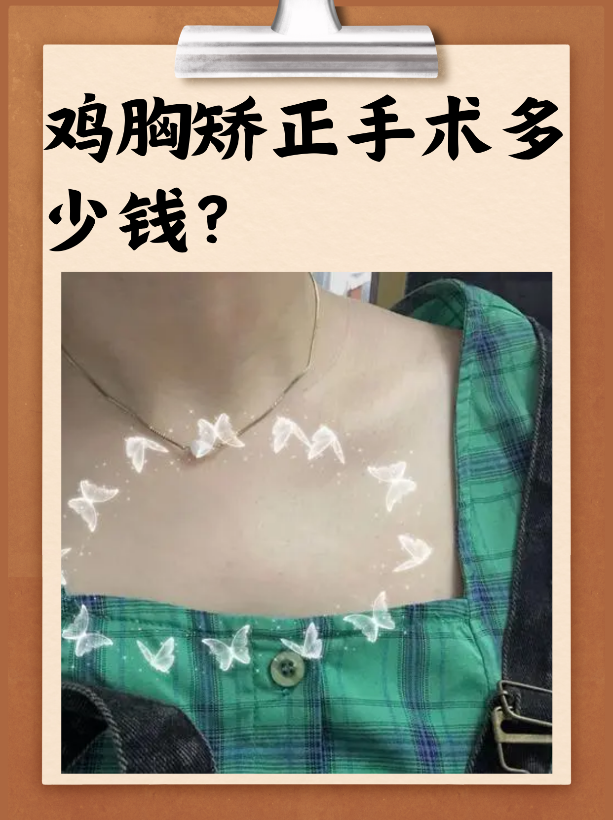 请问我是鸡胸吗?今天发了个照片,