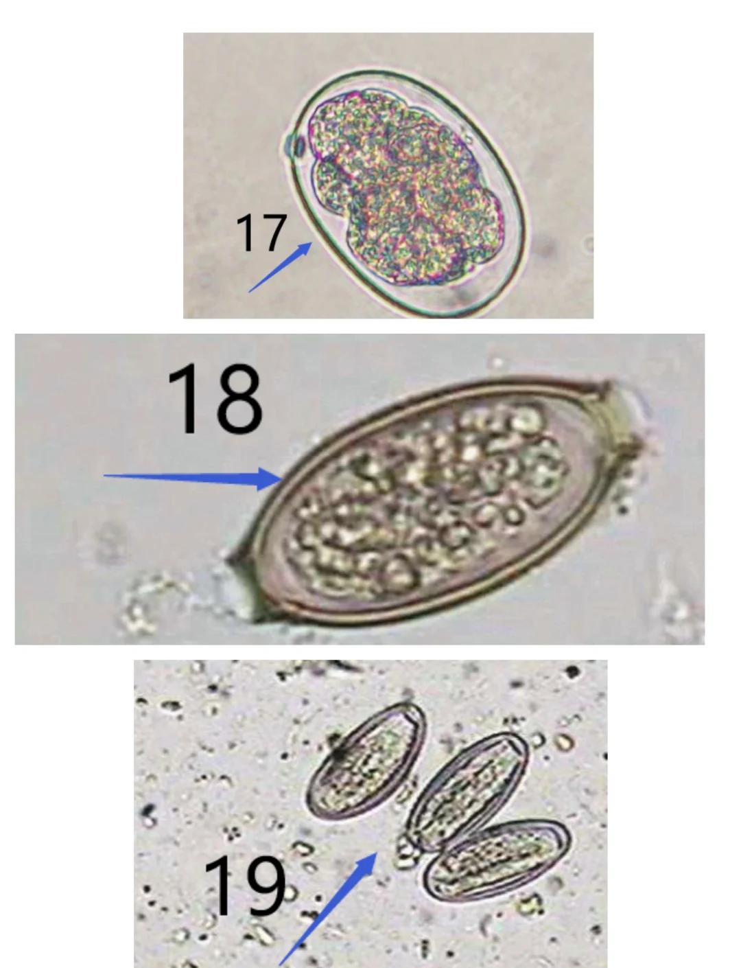 屎肠球菌是什么