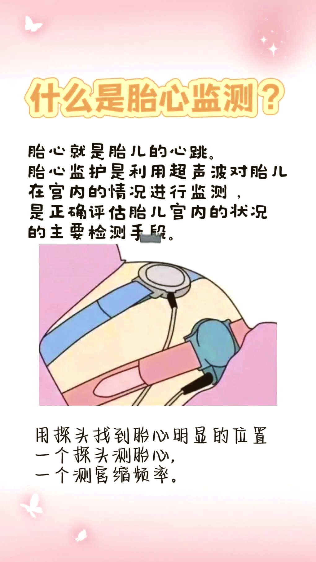 胎心监护不过怎么办?