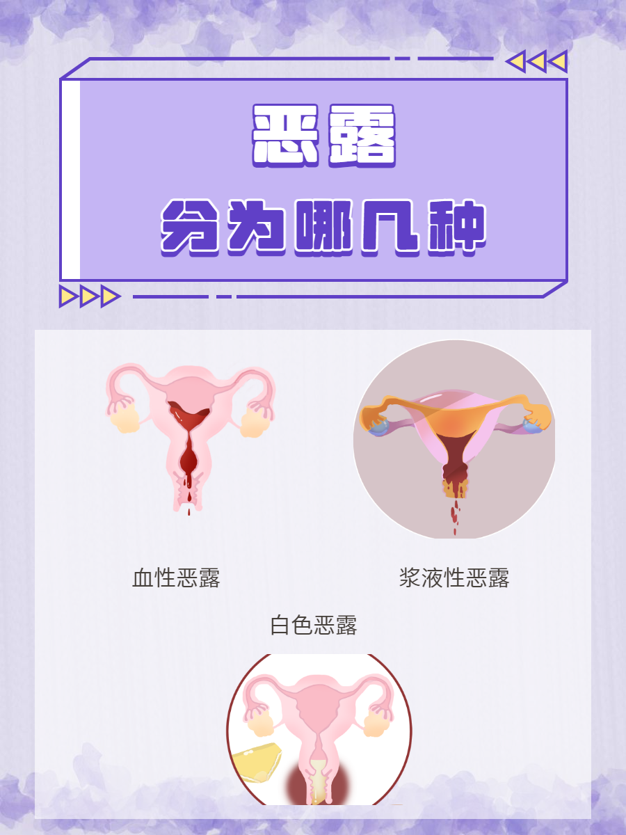 人流后多久可以排完恶露?