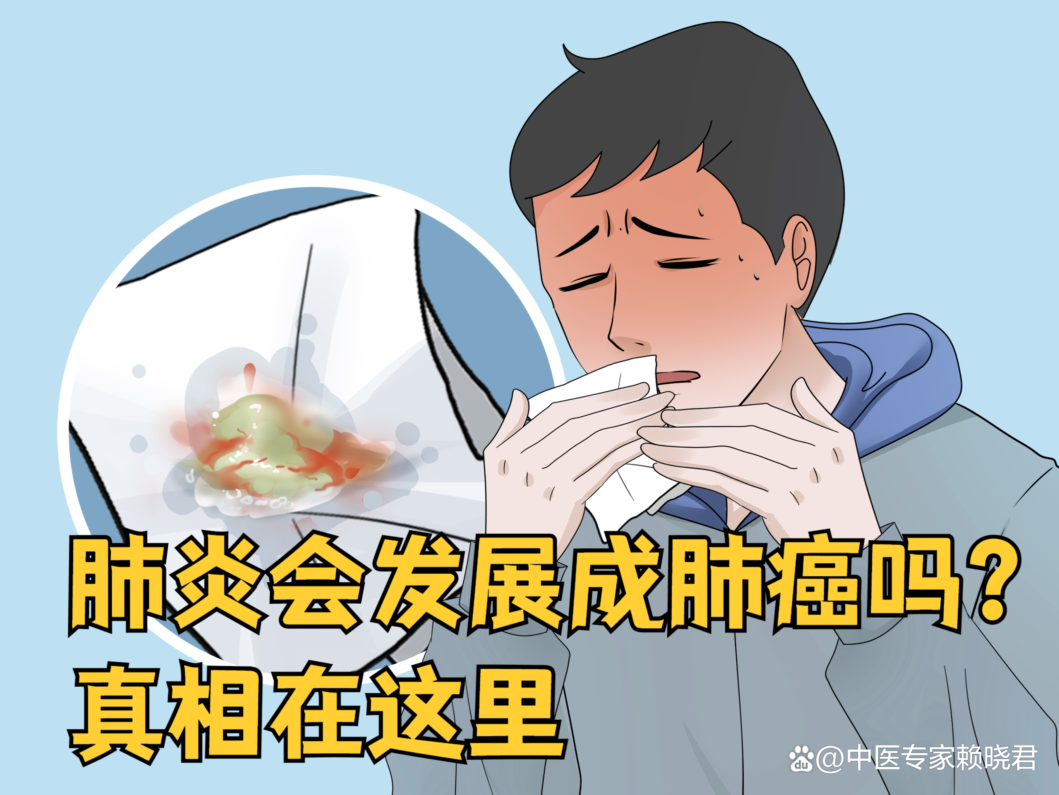 急性肺炎严重吗?