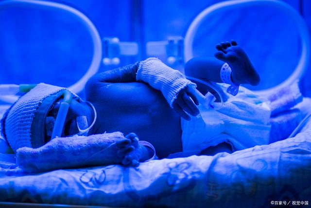 新生儿溶血性黄疸的症状