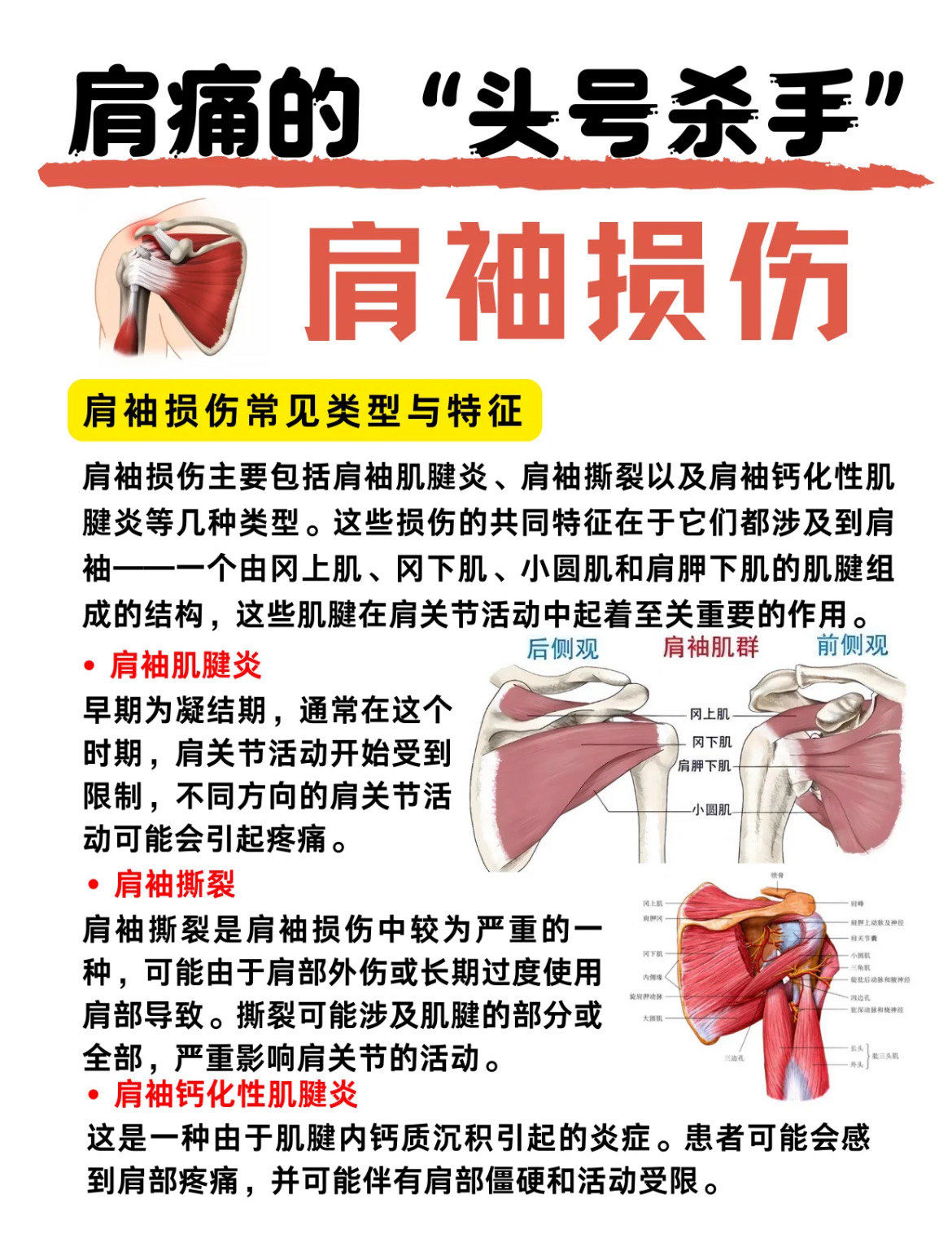 肩周炎有哪些症状