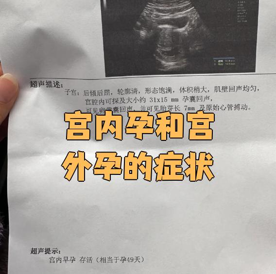 一般宫外孕多久有反应