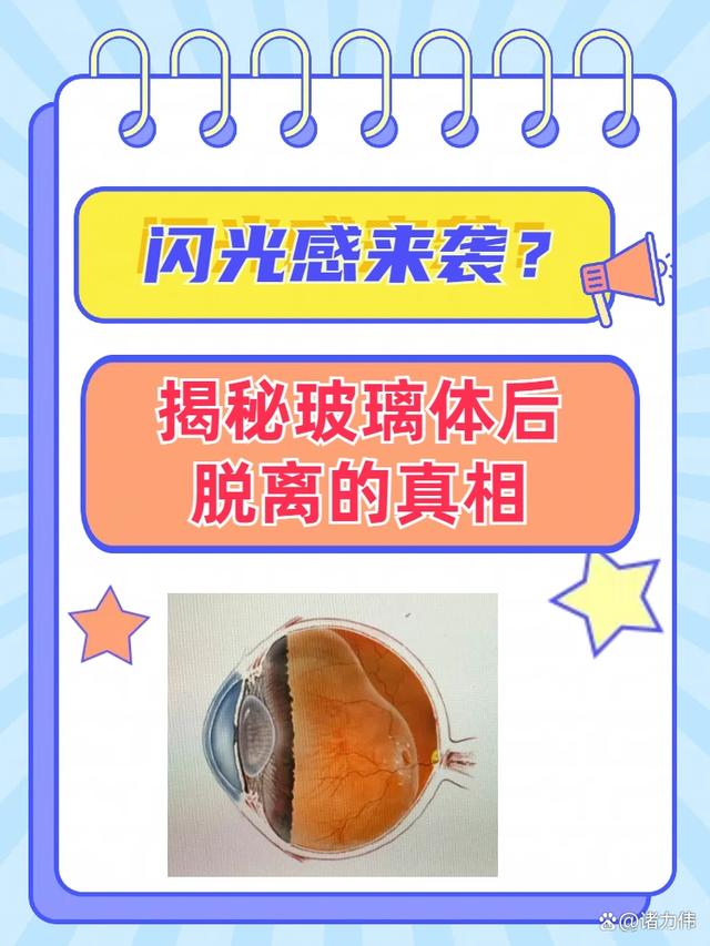 什么是玻璃体后脱离